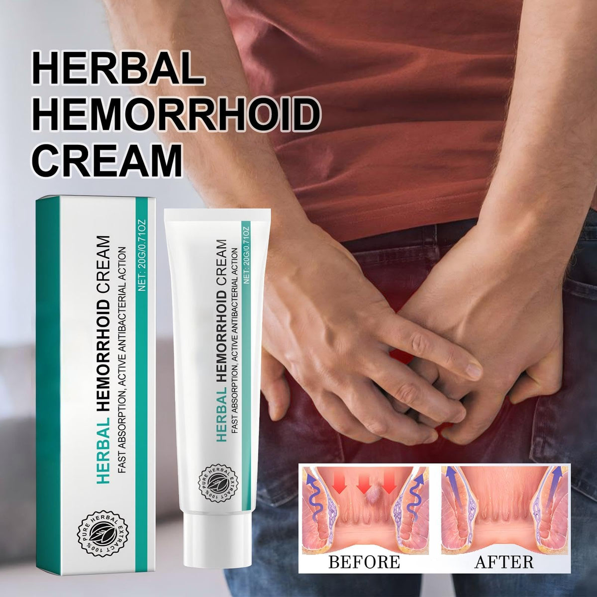 Hemorrhoid Cream, Herbal Hemorrhoid Ointment, Natural Itching & Burning Relief Hemorrhoidal Cream, External Discomfort Support for Men Women 20g - Maple Wellness Supplements